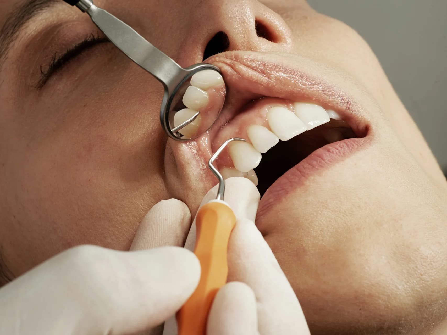 Root Canal Turkey — Microscope-Guided, Single-Visit, Painless