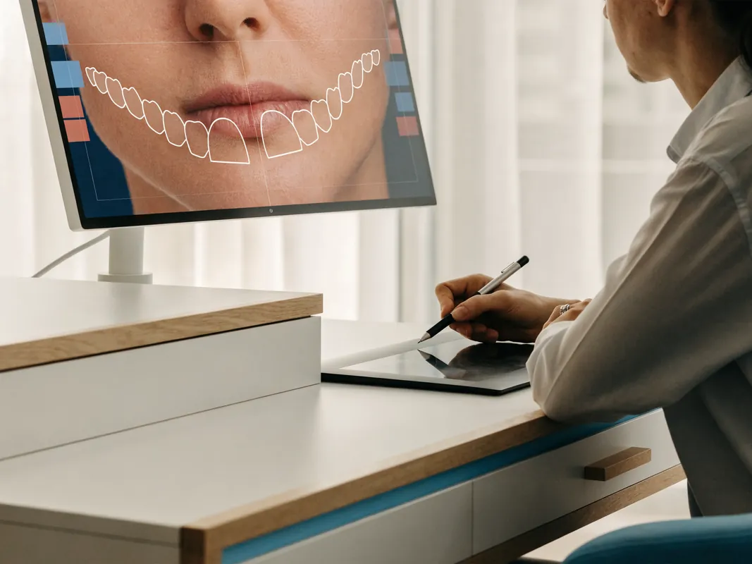 تصميم ابتسامة رقمي قيد الإعداد، مع ترتيب مقترح للأسنان مركّب فوق صورة المريض